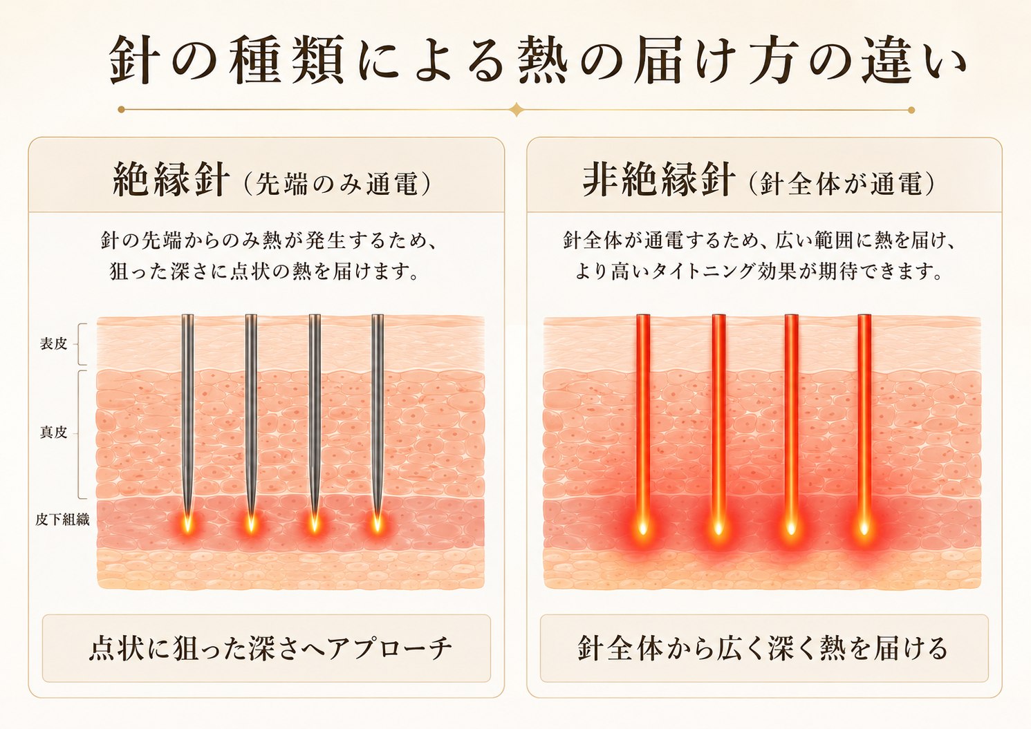 絶縁針と非絶縁針による熱の届け方の違い