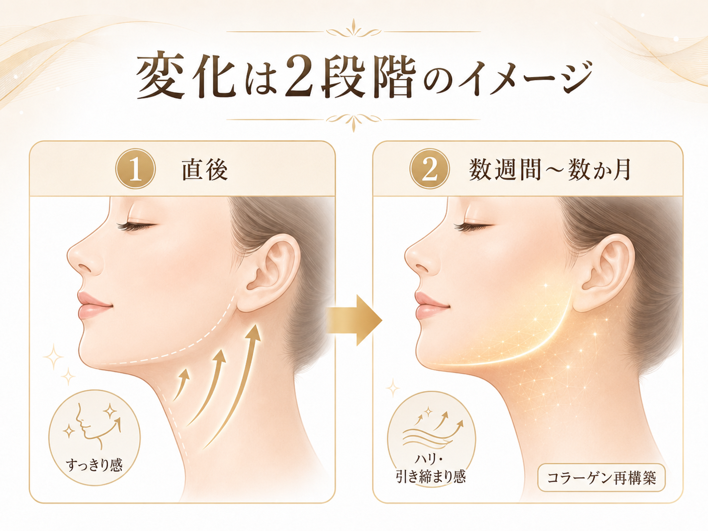 施術直後と数週間から数か月後の変化イメージ