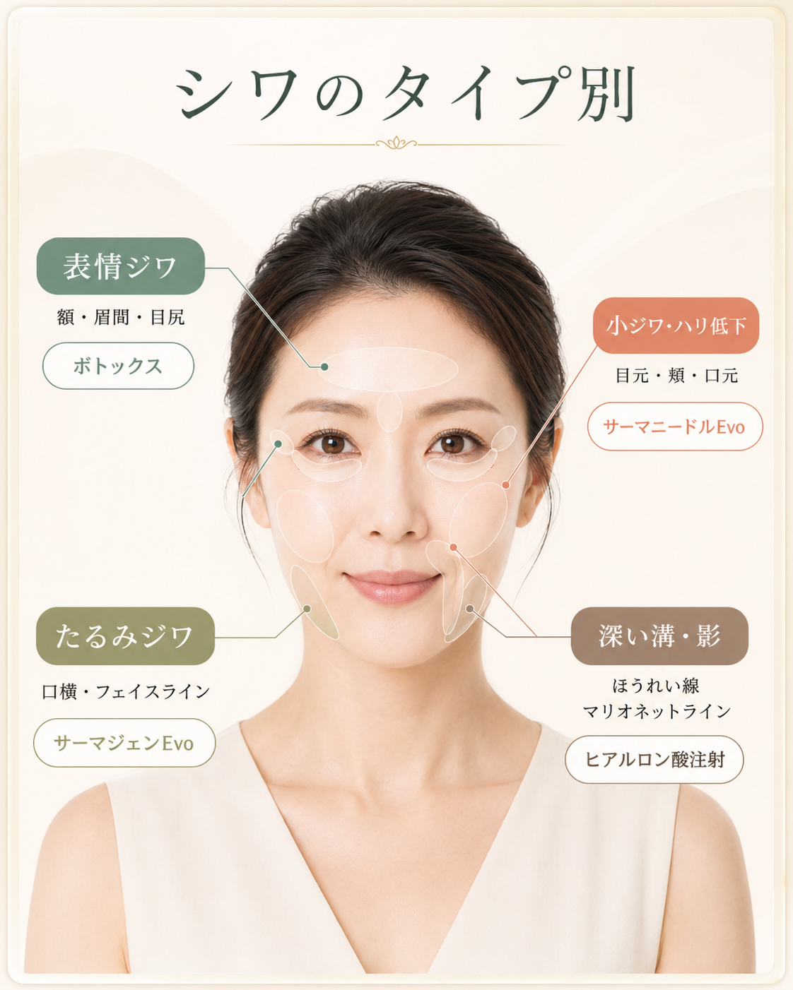 表情ジワ、小ジワ、たるみ、ほうれい線の治療候補を示す説明図