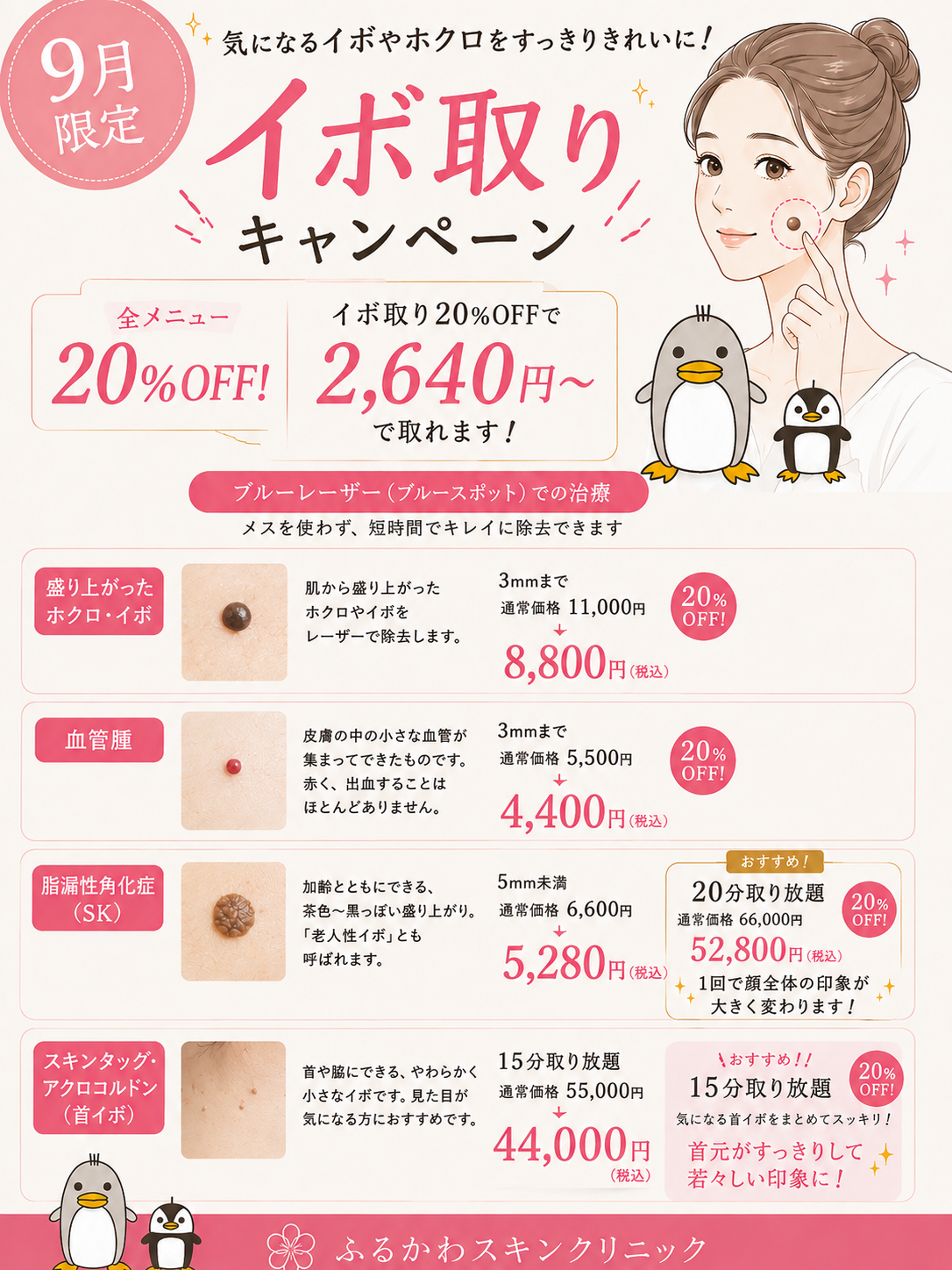 2026年9月限定 イボ取りキャンペーン。対象となるイボ取りメニューの施術料金が20％OFF。詳細なサイズ区分と料金は料金一覧をご確認ください。
